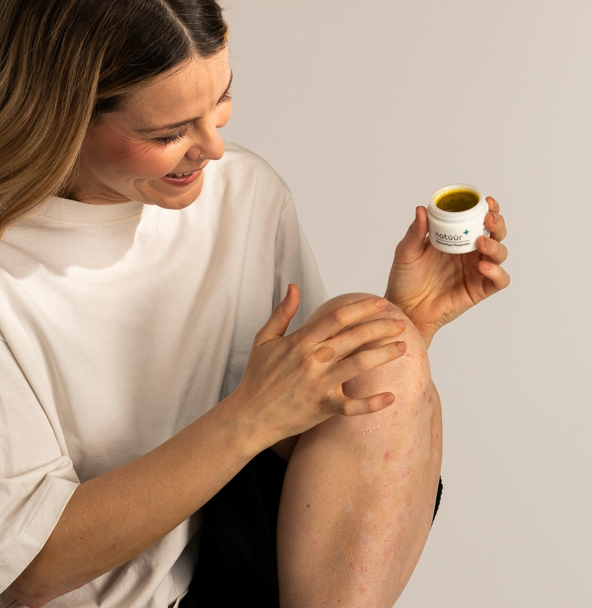 Man sieht, wie sich die Frau mit braunen Haaren die Pflegesalbe auf das Knie gibt, Dieses Knie ist von Psoriasis betroffen.