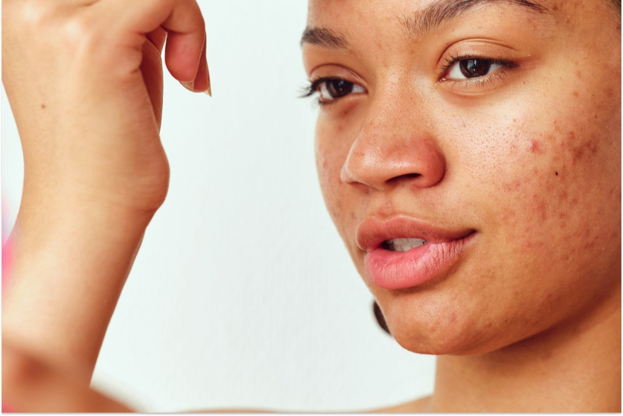 Empfindliche Haut - 10 Auslöser