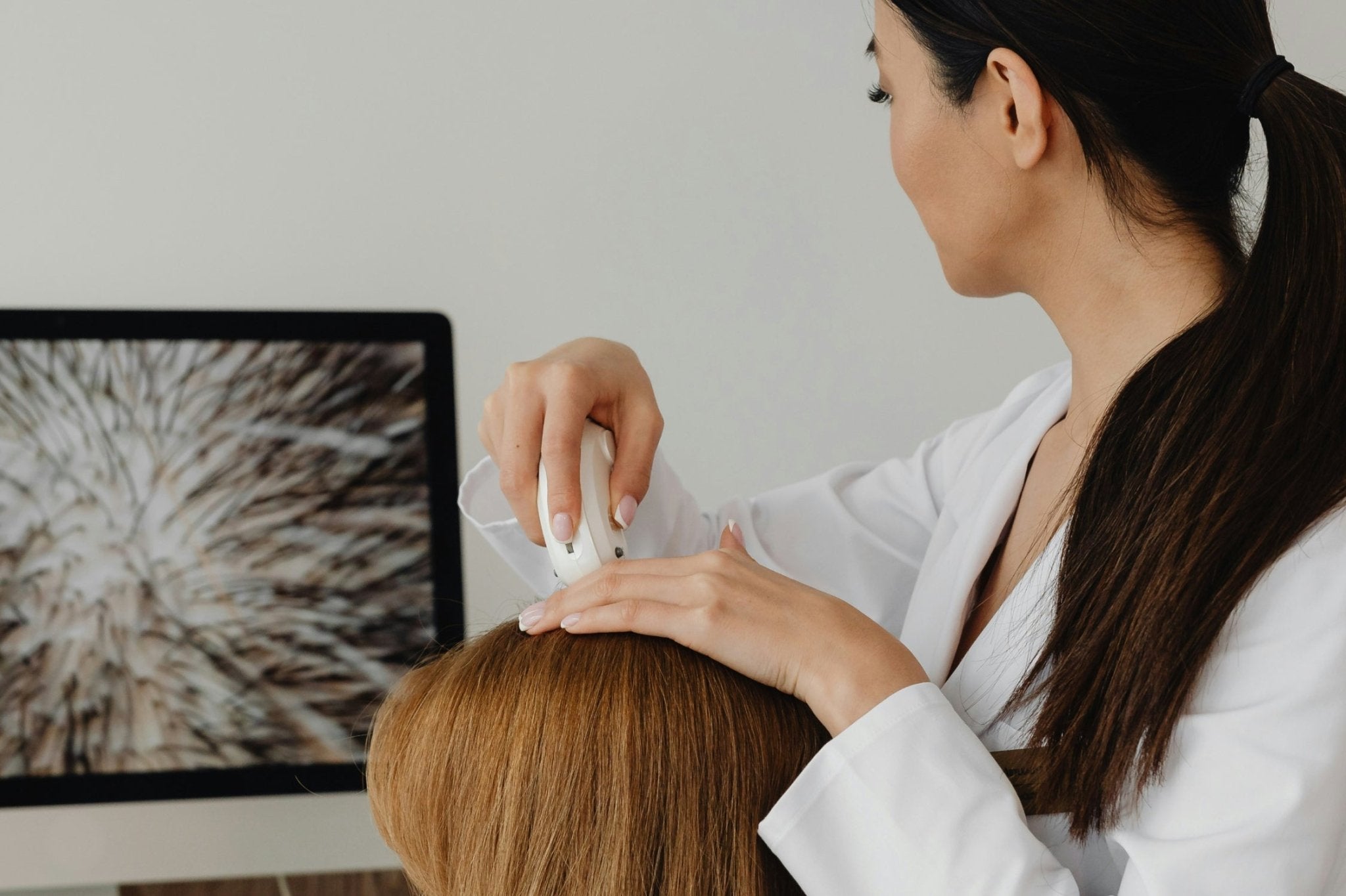 Trockene Kopfhaut behandeln: Die besten Naturprodukte