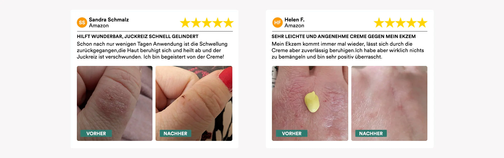 Man sieht zwei fünf Sterne Produkt-Bewertungen über die natüür Pflegecreme. Auch sieht man vorher/nachher Vergleichsbilder von Nutzern, die die Creme auf der Haut aufgetragen haben.