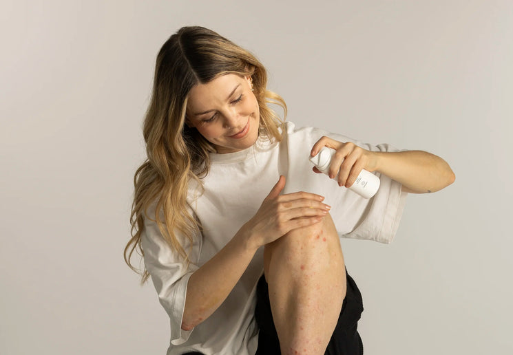 Eine Frau mit blond-braunen Haaren und weißem T-Shirt sitzt auf dem Boden. Ihr Knie ist angewinkelt und von Psoriasis betroffen. In der Hand hält sie die Pflegecreme von natüür.
